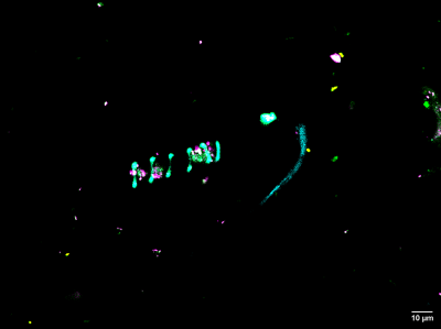 14-Microbiota Fluorescente-Espirulina y Bacterias en colaboración