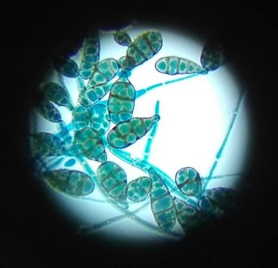 Hisilicon Balong